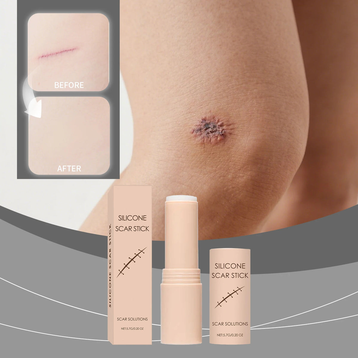 Scar Repair Stick: Smooth Skin Solution