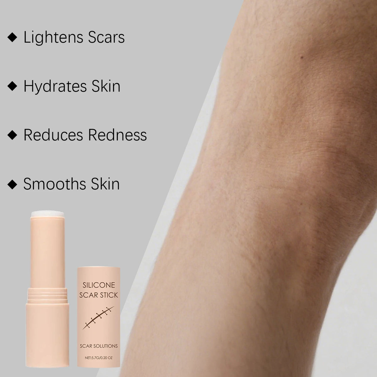 Scar Repair Stick: Smooth Skin Solution