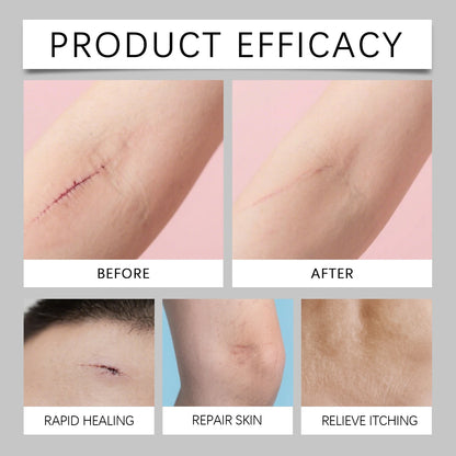 Scar Repair Stick: Smooth Skin Solution